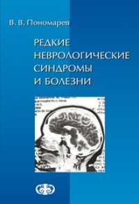 cover of the book Редкие неврологические синдромы и болезни