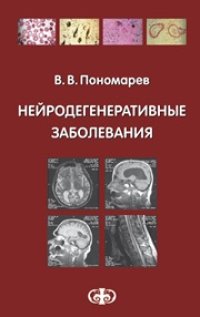 cover of the book Нейродегенеративные заболевания: Руководство для врачей