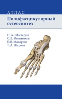 cover of the book Полифасцикулярный остеосинтез