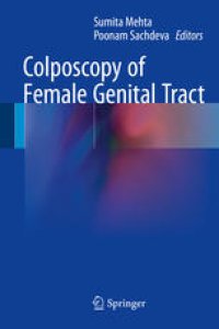 cover of the book Colposcopy of Female Genital Tract