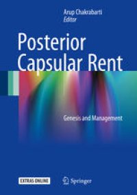 cover of the book Posterior Capsular Rent: Genesis and Management