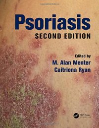 cover of the book Psoriasis, Second Edition