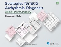 cover of the book Strategies for ECG Arrhythmia Diagnosis: Breaking Down Complexity