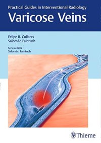 cover of the book Varicose Veins