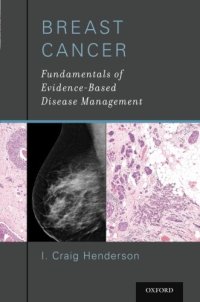 cover of the book Breast Cancer Fundamentals of Evidence-Based Disease Management