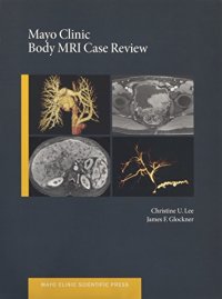 cover of the book Mayo Clinic body MRI case review