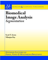 cover of the book Biomedical Image Analysis Segmentation