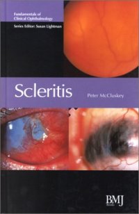 cover of the book Scleritis