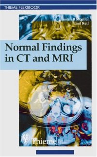 cover of the book Normal Findings on CT and MRI