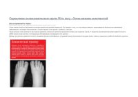 cover of the book Отеки нижних конечностей