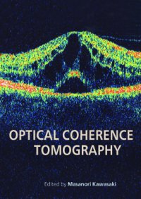 cover of the book Optical Coherence Tomography