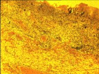 cover of the book Атлас по патологической анатомии