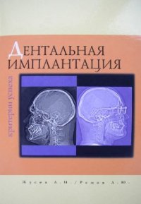 cover of the book Дентальная имплантация. Критерии успеха