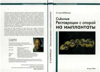 cover of the book Съемные реставрации с опорой на имплантаты