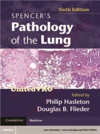 cover of the book Spencer's Pathology of the Lung 6th edition