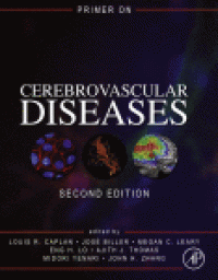 cover of the book Primer on Cerebrovascular Diseases