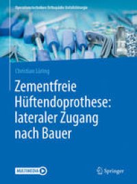 cover of the book Zementfreie Hüftendoprothese: lateraler Zugang nach Bauer 