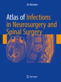 cover of the book Atlas of Infections in Neurosurgery and Spinal Surgery