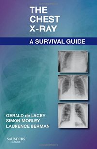 cover of the book The Chest X-Ray: A Survival Guide