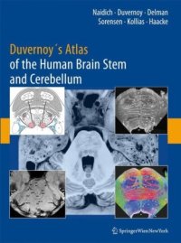 cover of the book Duvernoy's Atlas Of The Human Brain Stem And Cerebellum