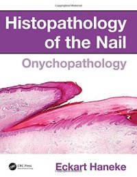 cover of the book Histopathology of the Nail : Onychopathology