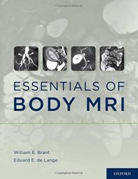 cover of the book Essentials of body MRI