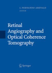 cover of the book Retinal Angiography and Optical Coherence Tomography