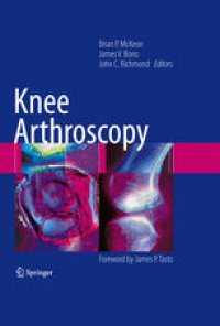 cover of the book Knee Arthroscopy