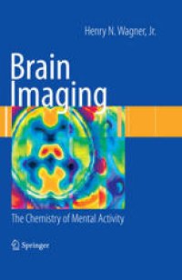 cover of the book Brain Imaging: The Chemistry of Mental Activity