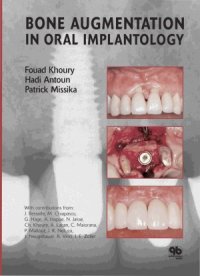 cover of the book Bone Augmentation in Oral Implantology