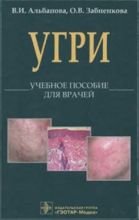 cover of the book L70. Угри