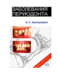 cover of the book Заболевания периодонта