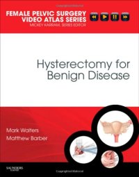 cover of the book Hysterectomy for Benign Disease