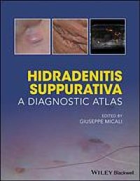 cover of the book Hidradenitis suppurativa : a diagnostic atlas