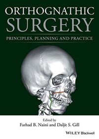 cover of the book Orthognathic Surgery: Principles, Planning and Practice