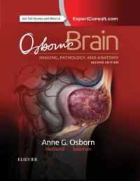 cover of the book Osborn’s Brain: imaging, pathology, and anatomy