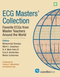 cover of the book ECG Masters Collection. Favorite ECGs From Master Teachers Around The World