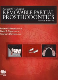 cover of the book Stewart’s Clinical Removable Partial Prosthodontics