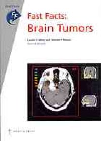 cover of the book Brain Tumors