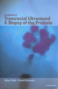 cover of the book Handbook of transrectal ultrasound and biopsy of the prostate