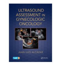 cover of the book Ultrasound assessment in gynecologic oncology