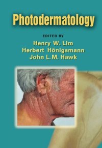 cover of the book Photodermatology