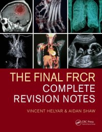 cover of the book The final FRCR : complete revision notes