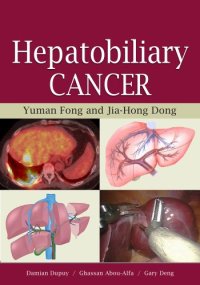 cover of the book Hepatobiliary Cancer