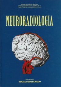 cover of the book Neuroradiologia