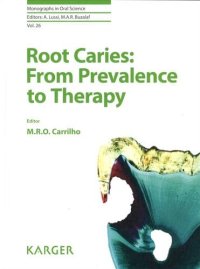 cover of the book Root Caries: From Prevalence to Therapy