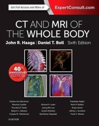 cover of the book CT and MRI of the Whole Body, 2-Volume Set, 6e, Volume II