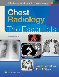 cover of the book Chest radiology: the essentials