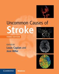 cover of the book Uncommon Causes of Stroke