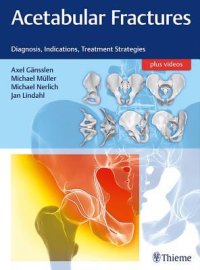 cover of the book Acetabular Fractures: Diagnosis, Indications, Treatment Strategies